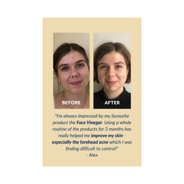 tonico-facial-gallinee-prebiotico-200m 2