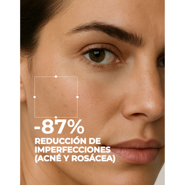 Segle Set Tratamiento Antiacné-Rosácea 2 x 30 ml